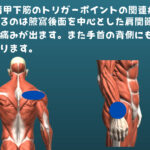 肩甲下筋のトリガーポイント