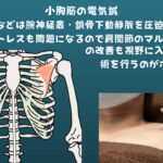 小胸筋の電気鍼