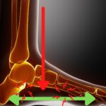 足底筋(腱)膜の超音波