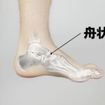 足の舟状骨の骨折の運動療法