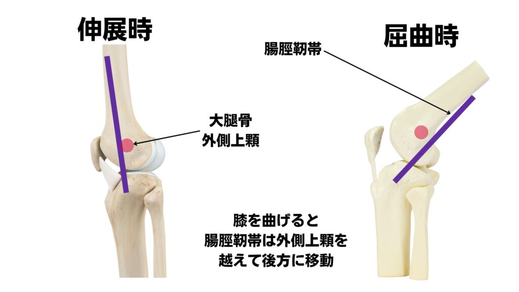 腸脛靭帯からランナー膝(ランナーズニー)について知ろう!当院での超音波を使用した一例 | 筑紫野市二日市の杏鍼灸整骨院