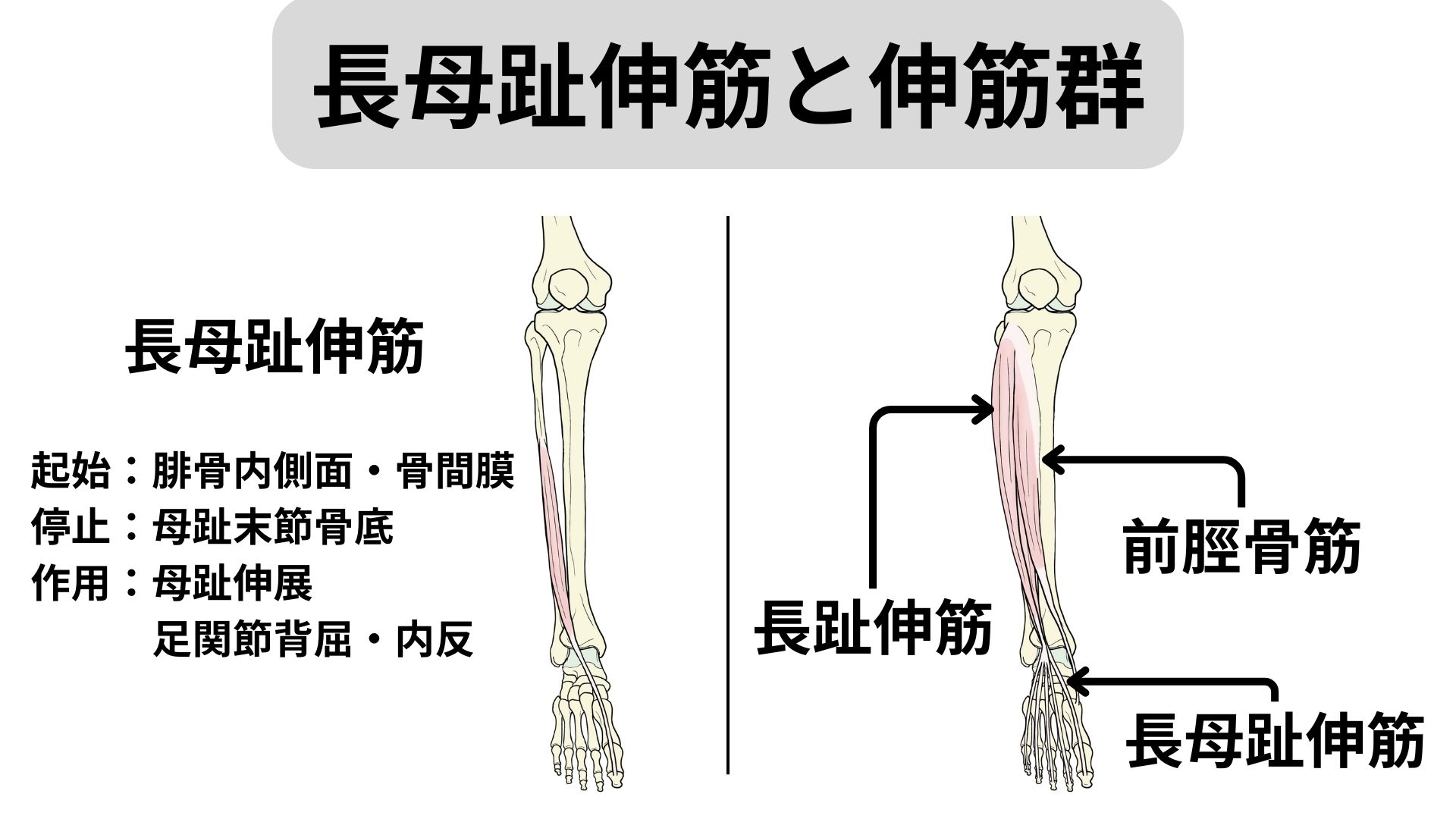 長母趾伸筋腱に対して行った超音波治療器|靴紐の結び方で負担が変わる | 筑紫野市二日市の杏鍼灸整骨院