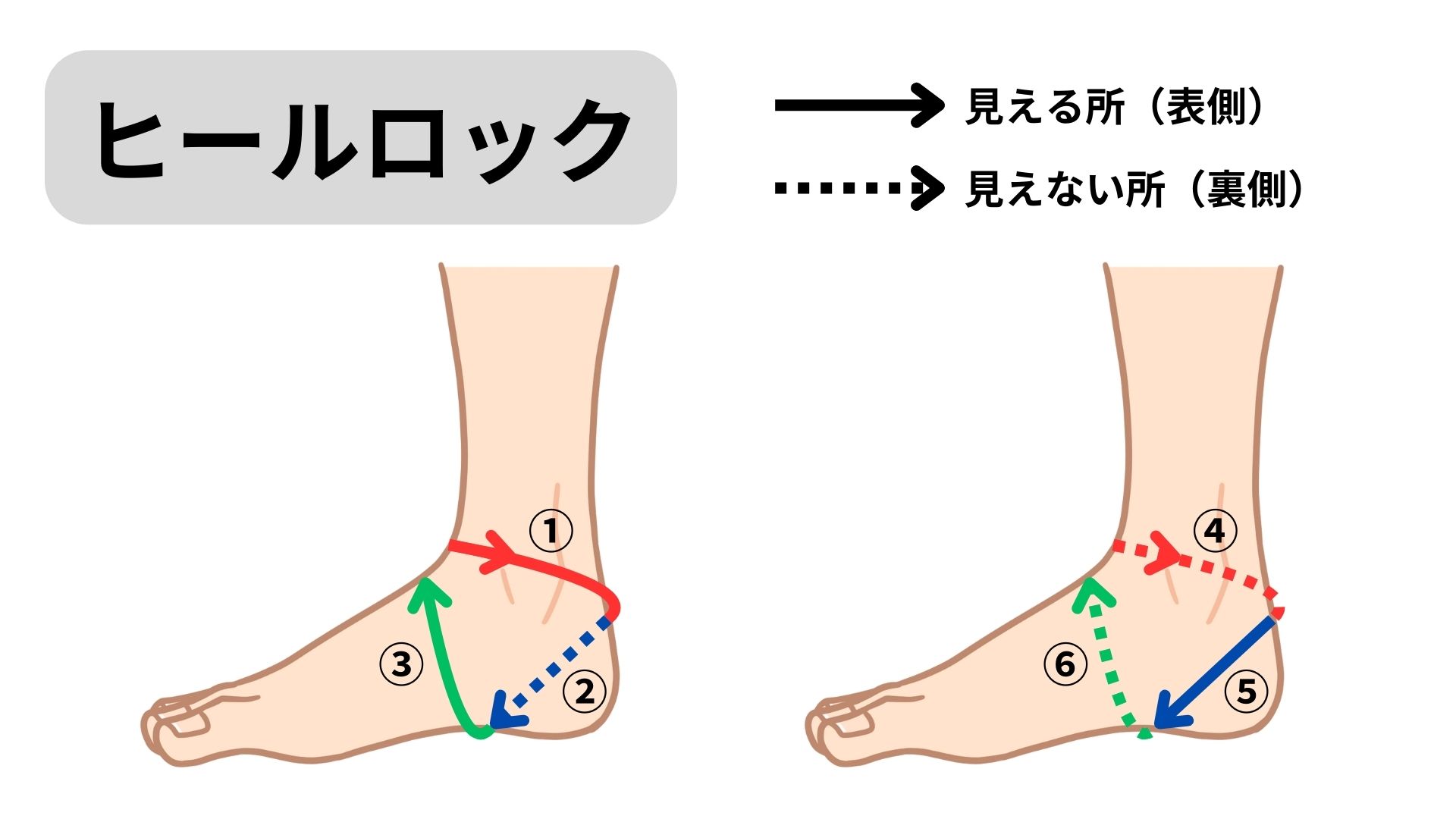 ヒール ロック テーピング