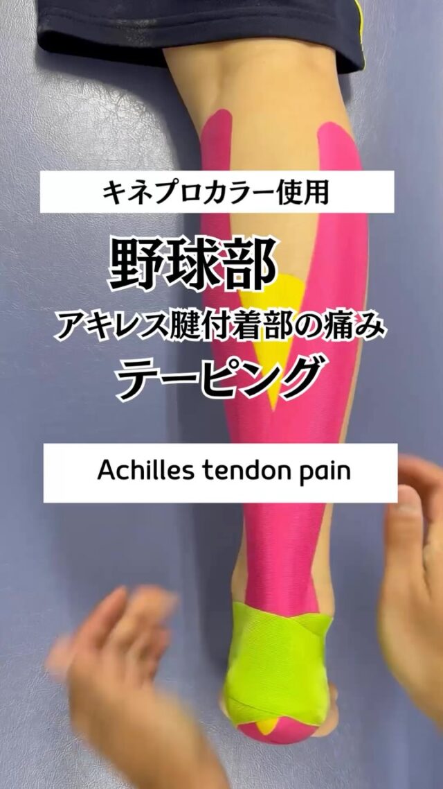 今回は野球選手のアキレス腱の痛みテーピングです😄

もうすぐセレクションやね‼️頑張れ👍😁
杏鍼灸整骨院
<open>9：00
<close>20：30（土曜日17：30）
<定休日>日、祝日

📍福岡県筑紫野市二日市中央4-11-1-2F
📞092-929-0809

#杏鍼灸整骨院 #筑紫野市 #太宰府市 #スポーツ障害 #整骨院 #鍼灸 #超音波 #福岡の整骨院 #アキレス腱の痛み #キネシオテープ #野球 #テーピング #伊藤超短波 #春日市 #小郡市　#taping　#トワテック #テーピングの巻き方